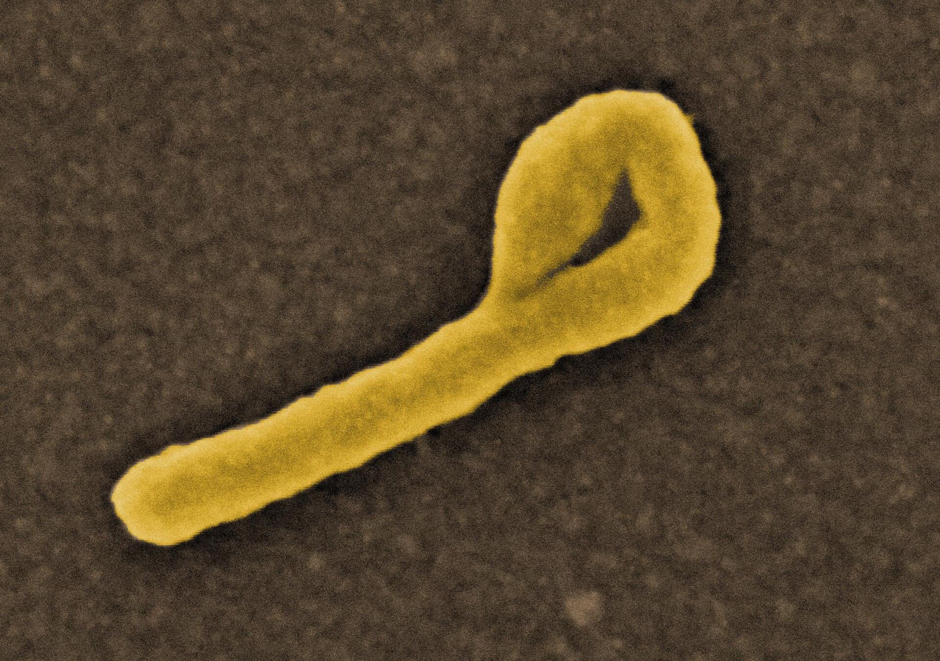 Častica vírusu eboly pod rastrovacím elektrónovým mikroskopom.