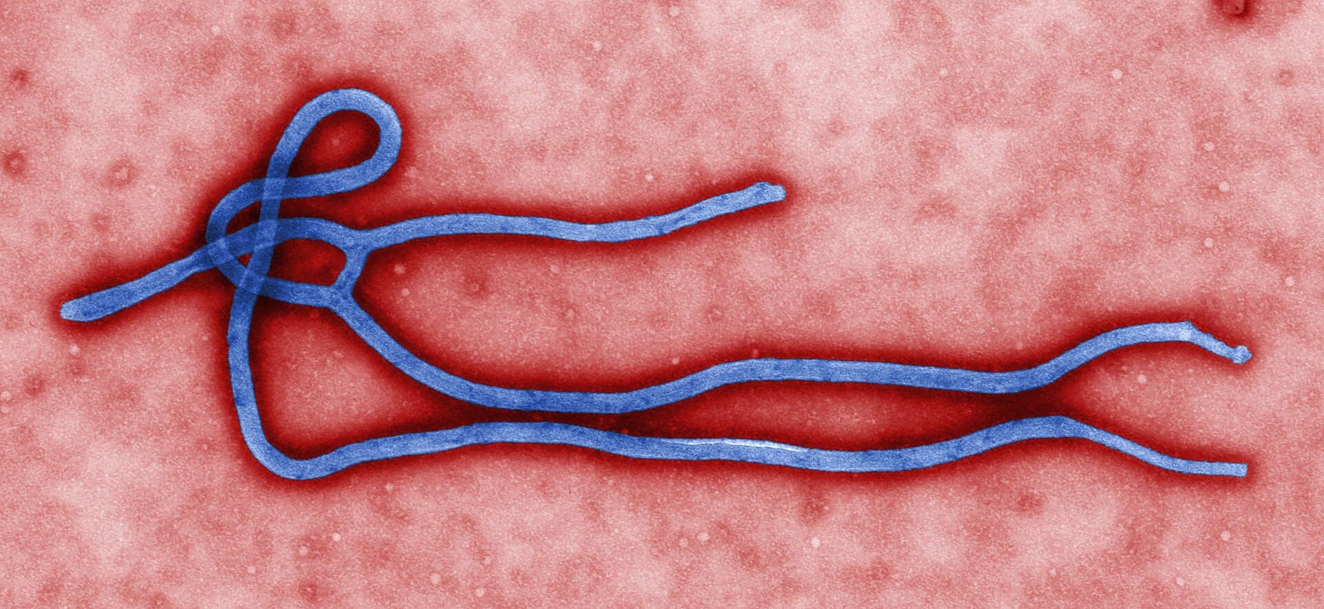 Kolorovaná snímka vírusu ebola z transmisného elektrónového mikroskopu.